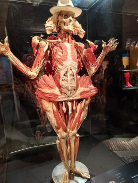 Eksponat na wystawie Body Worlds